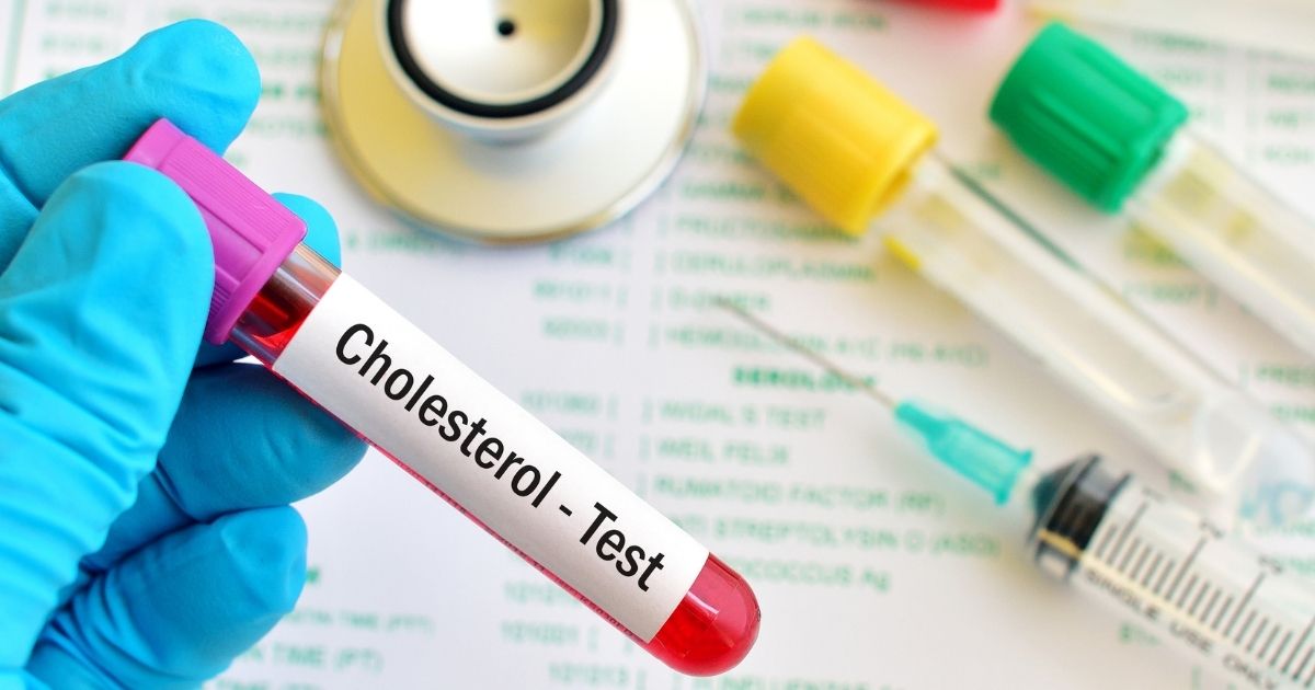 holesterol testiranje