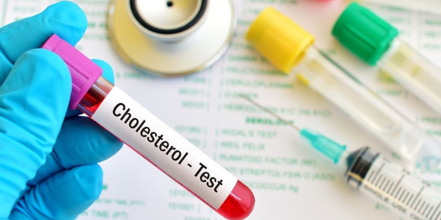 holesterol testiranje